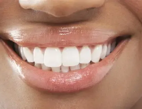 Hollywood Veneers for Christmas: Give Yourself the Gift of a Perfect Smile 🎄