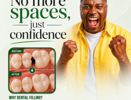 Dental Fillings: Restoring Your Teeth and Protecting Your Smile